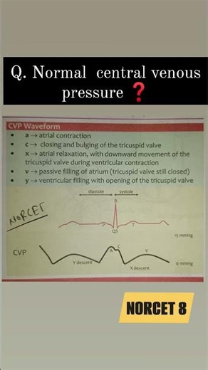 Central venous pressure #graph #aiims #norcetmcq #shortvideo