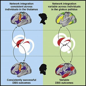 DBS: location, location, location
