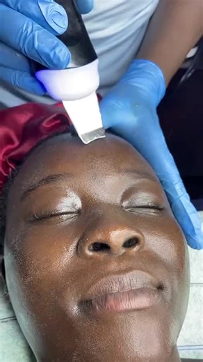 Essential beauty experts facials dont bleach beautify your own skin color with essential beauty experts #kampala_uganda #kampala_uganda #kampala_uganda🇺🇬🇺🇬🤝 #facialtreatment
