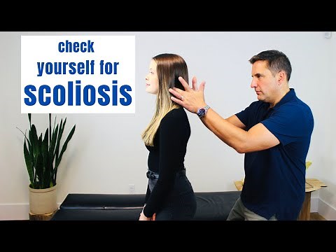 How To Check For Scoliosis - 4 Self Checks!