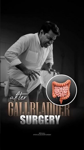 ⛔Life After Gallbladder Surgery (Cholecystectomy)
