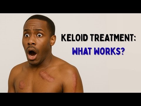 Top Treatments for Keloid Scars Ranked by Science