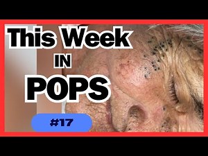 This Week in POPS #17