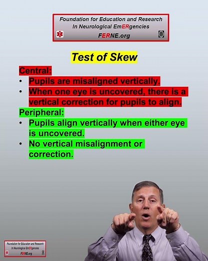 Does the Test of Skew Differ w/ Central vs. Peripheral Etiologies in Dizziness and Vertigo Patients?