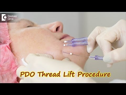 PDO Thread Lift Procedure. How is it done? Benefits and Side Effects-Dr.Srikanth V | Doctors' Circle