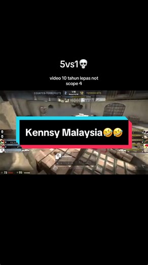 Epic CSGO Moments: 5v1 Not Scope Highlights
