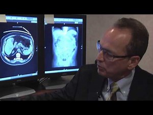 New Protocol for CT Colonography -- Mayo Clinic