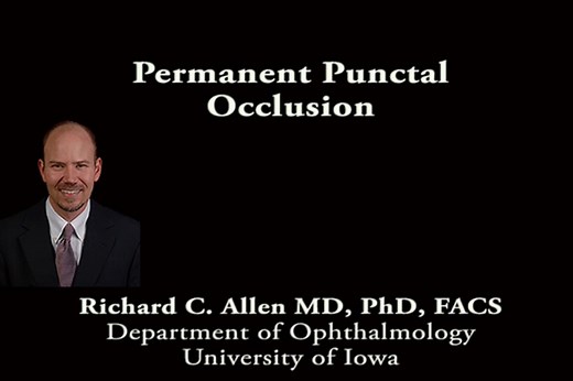 Permanent Punctal Occlusion (Punctal Cautery)