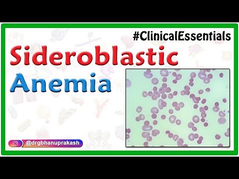 Sideroblastic Anemia : Causes, Pathogenesis, Clinical Presentation, Diagnosis, Treatment