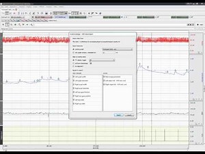 SMI BeGaze import and synchronization with BIOPAC