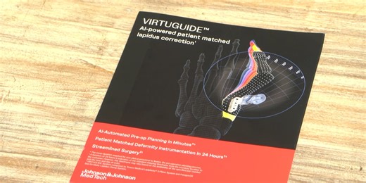 AI technology helps to create relief for bunion patients at Crestwood Medical Center