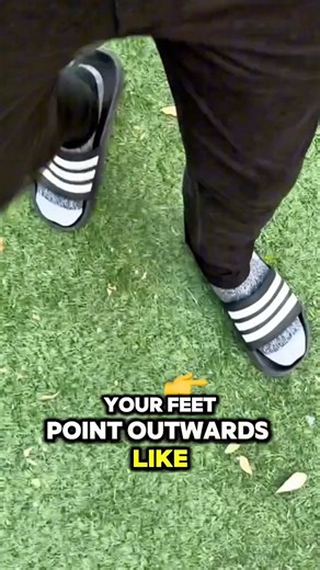 36K views · 224 reactions | Does one or both of your feet point...