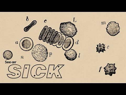 What Exactly is Lupus?