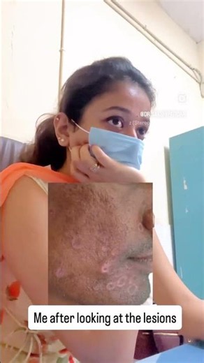 When the history says one thing but the skin says another…..#awareness #dermatology #education