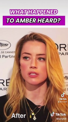 Unveiling Potential Plastic Surgery Procedures on Amber Heard