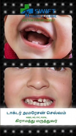 Baby Grinding Teeth at Night | Should Parents Worry? Causes & Solutions Explained