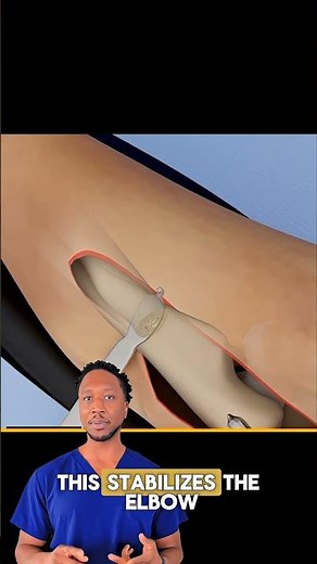 ⚙️RadialHeadReplacement: Restoring Elbow Function #Shorts