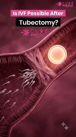 Can You Get Pregnant After a Tubectomy? 🤰 (Tubal Ligation & IVF Bypass Explained in 3D) #shorts #ivf