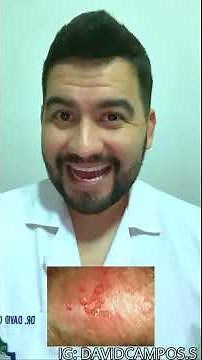 Herpes Genital: Tratamento e Dicas com Dr. David Campos
