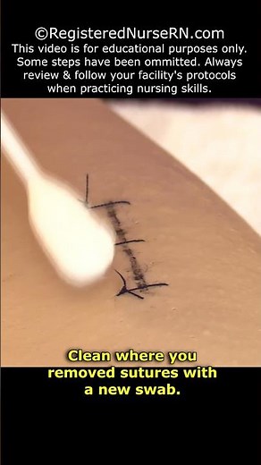 How to Remove Stitches (Sutures) Nursing Clinical Skill #shorts #nursing #nurse