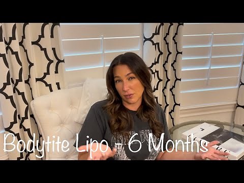 Bodytite Lipo - 6 Month Update