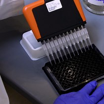 Video: A High-Throughput Electrochemiluminescence 7-Plex Assay Simultaneously Screening for Type 1 Diabetes and Multiple Autoimmune Diseases