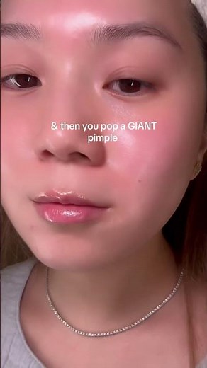 Popping a giant pimple 😮‍💨
