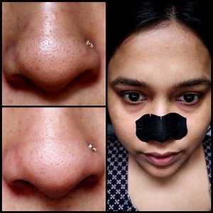 100% Blackhead Removal Method /Guaranteed Result In Live Video #BlackheadRemoval #SkincareRoutine #ClearSkin #AcneTreatment #SkinCareTips #PoreClearing #DeepCleanse #BlackheadExtraction #SkincareCommunity #HealthySkin #BeautyTips #PoreStrips #SkinCareProducts #AcneFree #FacialTreatment #GlowUp #CleanPores #SkinCareJourney #Exfoliate #SkincareAddict | Indian Beauty Solutions