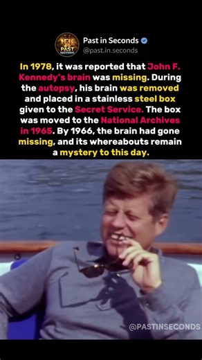 The U.S. President Whose Brain Went Missing