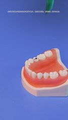 Ever Wondered How Dentists Pull Teeth? Here’s the Breakdown 😁
