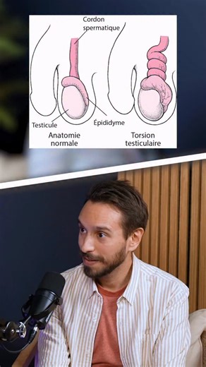 Doctochou | Dr Elodie Adler pédiatre on Instagram: "Dans cet épisode de Pediatime, on reçoit Alexis chirurgien pédiatrique @lechirped pour répondre aux questions que beaucoup de parents se posent… sans toujours oser les poser. 👉 Décalottage : ce qu’il faut faire (ou pas) ? 👉 Douleurs abdominales : comment savoir si c’est grave et quand faut-il aller aux urgences ? 👉 Balanite : comment la reconnaître et quoi faire ? 👉 Douleurs testiculaires : urgence ou non ? 👉 Hernie chez l’enfant : quand o