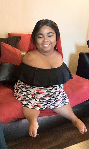 Woman with no arms & knees finds love 💕 #reels #disability #wedding #marriage #dating #noarms #nolegs | Love Don't Judge