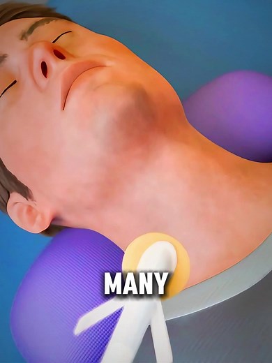 Thyroid Nodule Ablation Explained! #thyroidnodules #ThyroidAblation #endocrinology #medicalanimation