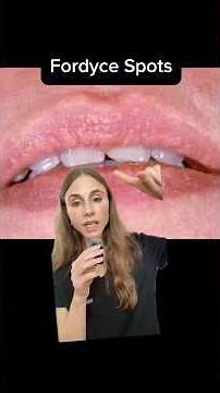 What Are These White Bumps? 😳 #dermatologist