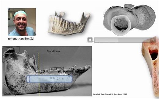 Mapping of Trabecular Bone Anisotropy in 3D