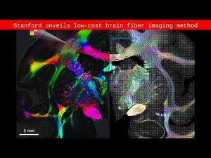 Stanford unveils low-cost brain fiber imaging method - Byte News Daily