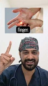 What is TRIGGER FINGER ??? #triggerfinger #finger #physiotherapist #nursing #medicalstudent #doctor