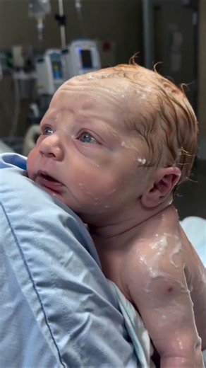 Beautiful Newborn Baby Moments After Birth | First Moments of Life