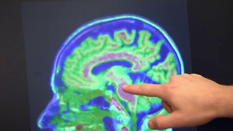 Study finds brain training games may help protect against dementia | Haystack News