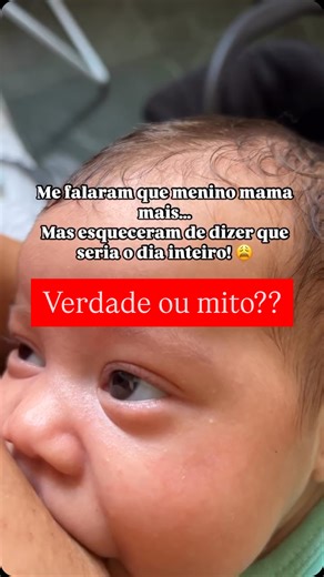 🧠 O que dizem os estudos e evidências? 1. Demanda energética: • Meninos, em média, têm uma massa corporal maior e crescimento ligeiramente mais rápido nos primeiros meses, o que pode levar a uma maior demanda por leite. • Isso não significa que todos os meninos mamem mais, mas que podem precisar de mais leite em algumas fases do desenvolvimento. 2. Padrões de sucção: • Estudos apontam que não há diferenças significativas entre meninos e meninas no padrão de sucção eficiente. • Porém, fatores in