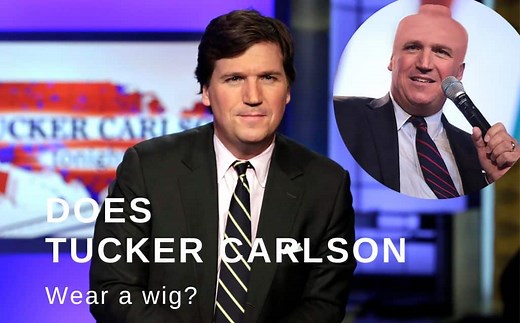 Does Tucker Carlson Wear a Wig, Toupee, or Hair System?