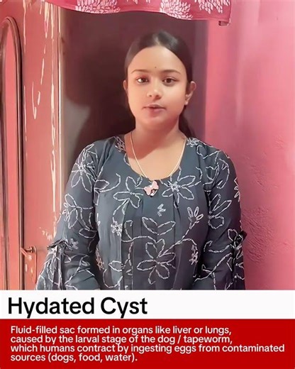 Hydatid Cyst Patient Testimonial - Dr. Pallavi Purwar