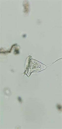 Glockentierchen Vorticellidae under the microscope #science #microscope 7