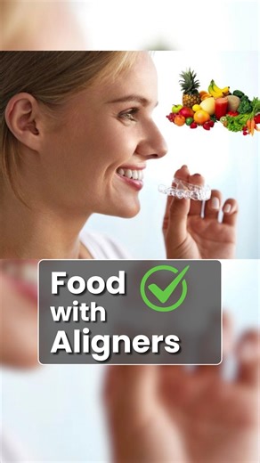 Aligners ke Saath Kya Kha Sakte Hain Aur Kya Nahi? | Clear Aligners Diet Tips #shorts Aligners
