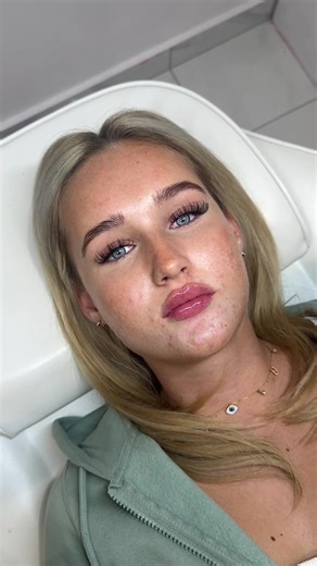 𝐁𝐄𝐅𝐎𝐑𝐄 & 𝐀𝐅𝐓𝐄𝐑…🪽 My gorgeous client came into today for 1.1ml lip filler using Russian Technique, giving her the most dreamiest lips to compliment her face perfectly! ⏳All appointments can be made through the booking link or DM Booking Link- https://enhancedbyellie.setmore.com #lipfiller #russianlips #lipfillermiddlesbrough #middlesbrough