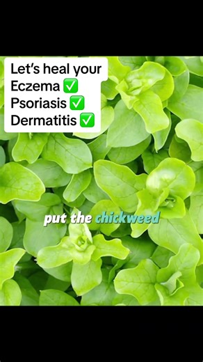 Recipe to heal your eczema and psoriasis #healthyliving #naturalremedies #herbalremedies #remedy #chickweed #eczema #eczemaawareness #eczemahealing #psoriasis #psoriasiswarrior #psoriasisawareness