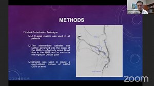 MMA Embolization for Subdural Hematoma: The Mount Sinai Experience - Physician's Channel - Mount Sinai New York