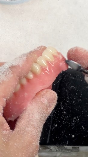 73K views · 521 reactions | Denture trimming to ensure the best possible fit! | Luke Kahng | Facebook