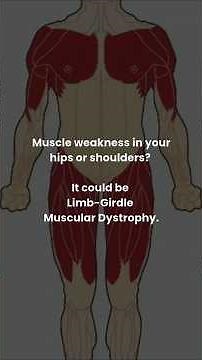 🤔 What is Limb-Girdle Muscular Dystrophy? | MD Talks Ep. 10 | LGMD Types & Symptoms ♿