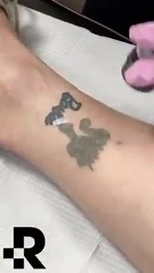 136K views · 21 reactions | Want to remove your tattoo for good? At...